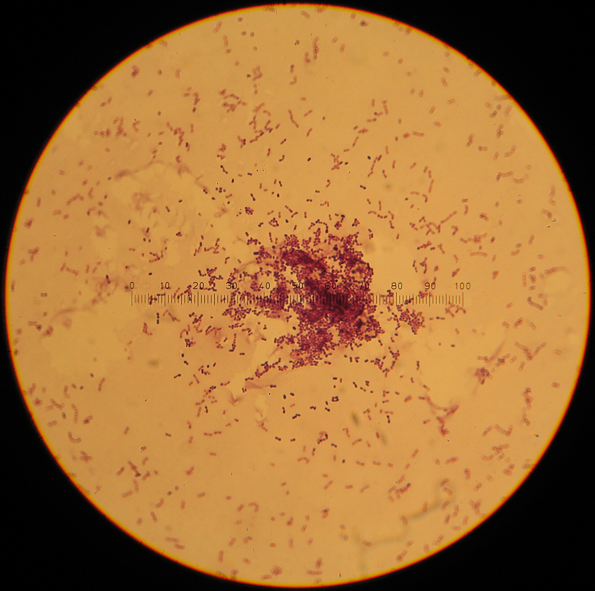 Imagem de referência relacionada a Lactococcus lactis, item descrito como registro de referência sobre Lactococcus lactis, organizado a partir de dados estruturados abertos