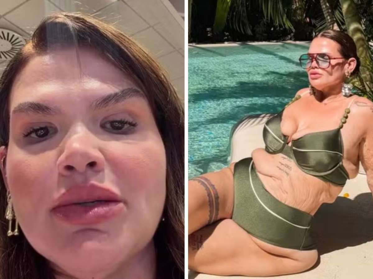 Thais Carla se prepara para cirurgia de remoção de pele após perder 120 kg: 'Virada de vida'