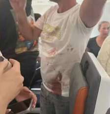 Imagem em rede social mostra passageiros com a camisa suja de sangue; briga entre pilotos fez voo que ia para Israel ser desviado — Foto: Reprodução Foto: Reprodução/Rede Social / Estadão