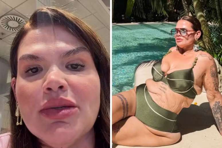 Thais Carla se prepara para cirurgia de remoção de pele após perder 120 kg: 'Virada de vida'