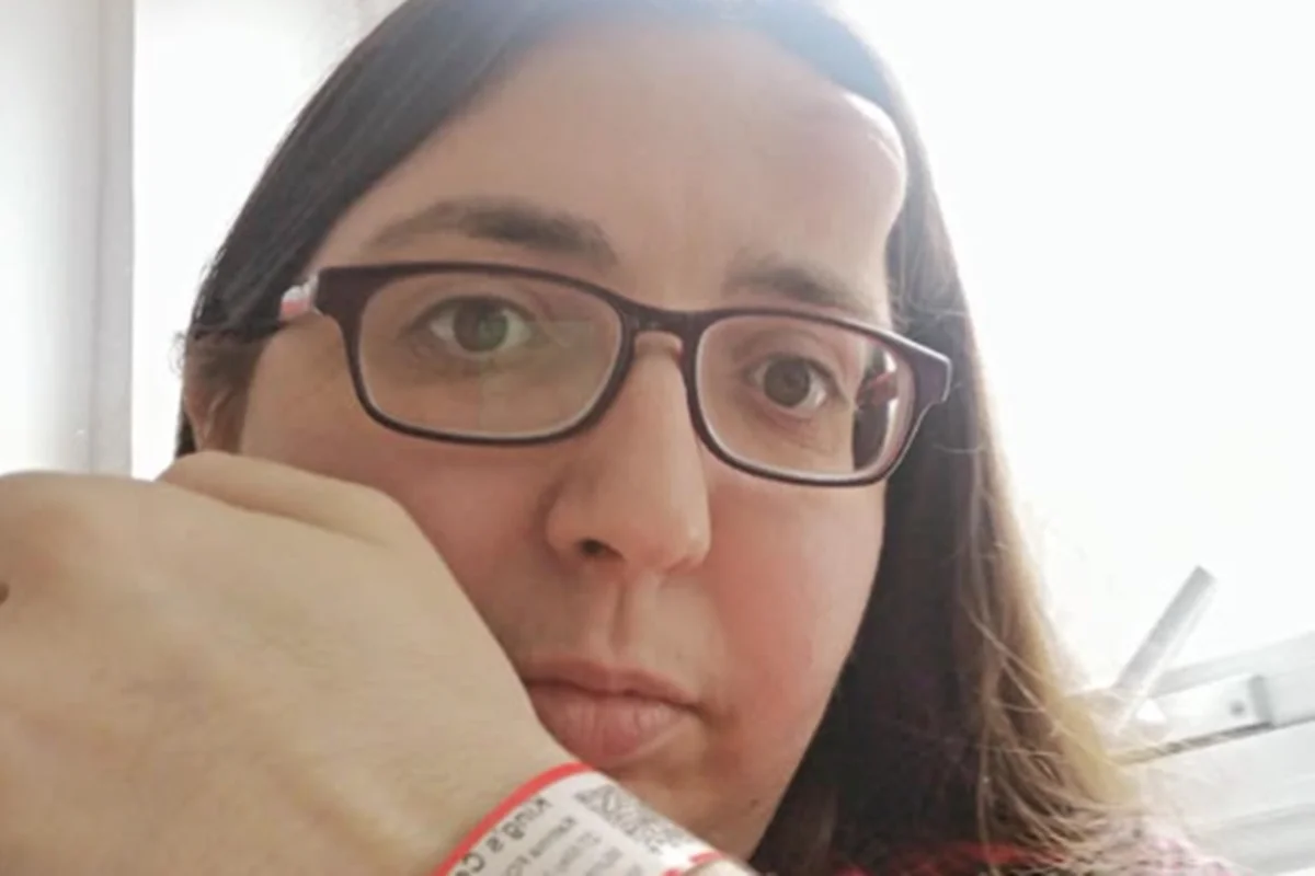 Mulher descobre câncer após caroço abrir buraco de 3 cm no crânio