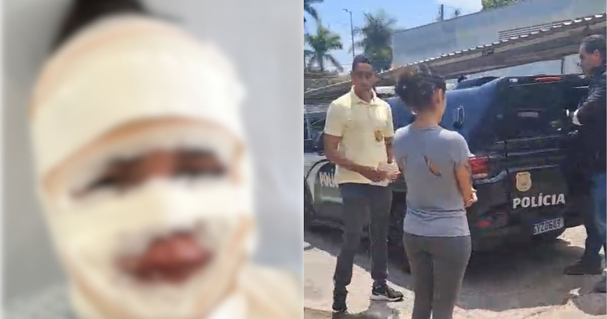 Fisioterapeuta é presa suspeita de jogar água quente no rosto de namorada do ex-companheiro em Belo Horizonte