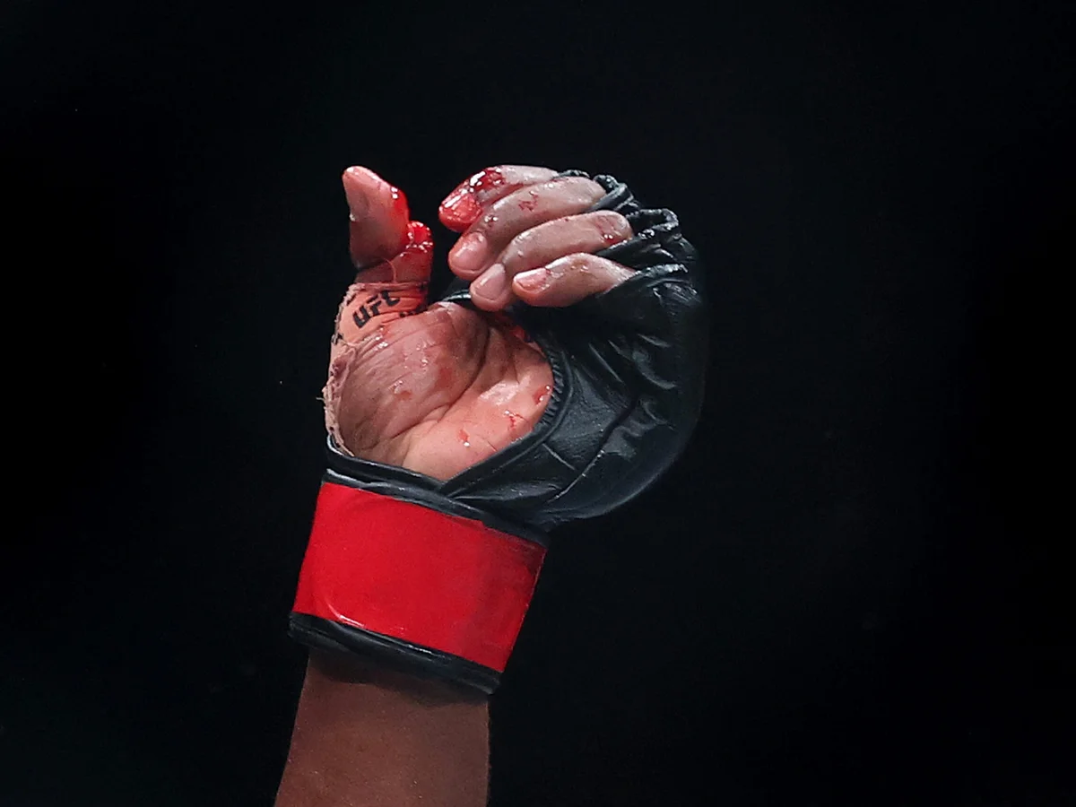 UFC: lutador recebe suspensão de seis meses por fratura exposta em duelo