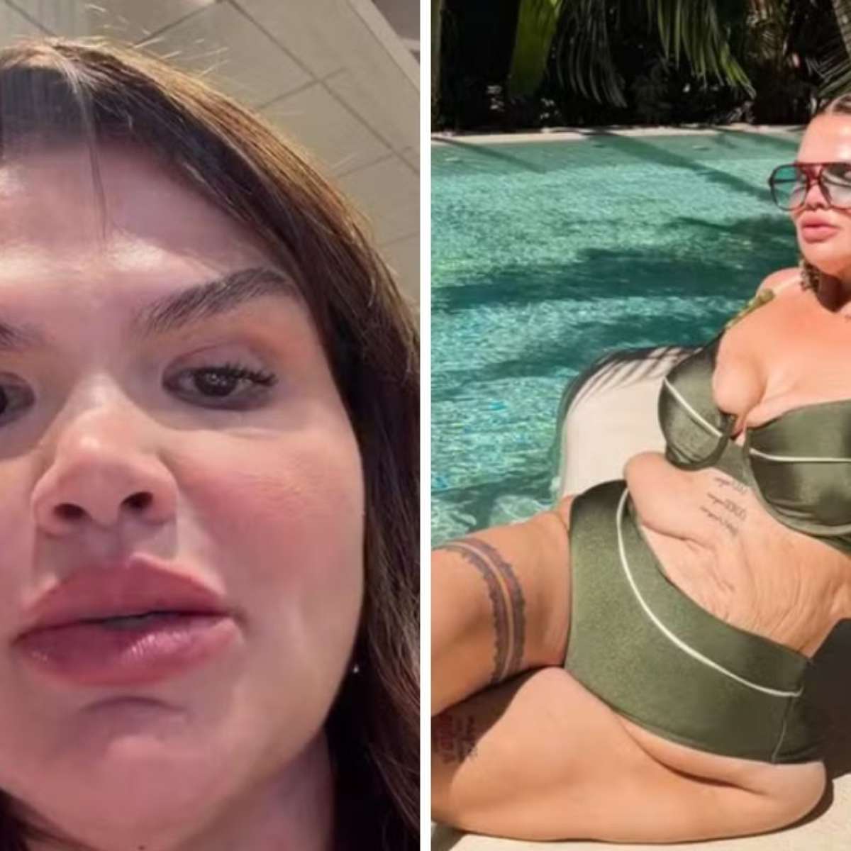 Thais Carla se prepara para cirurgia de remoção de pele após perder 120 kg: 'Virada de vida'