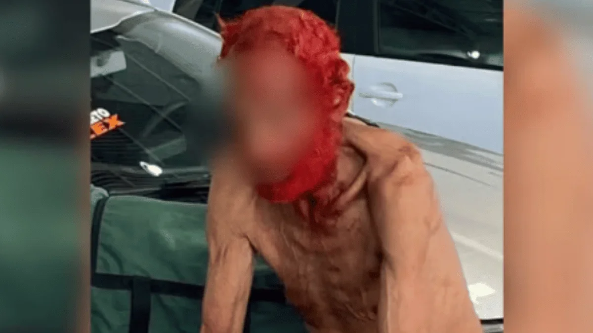 Empresário vira réu por pintar cabelo e barba de idoso em situação de rua