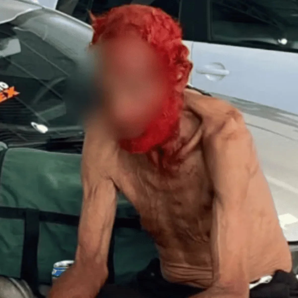Empresário vira réu por pintar cabelo e barba de idoso em situação de rua