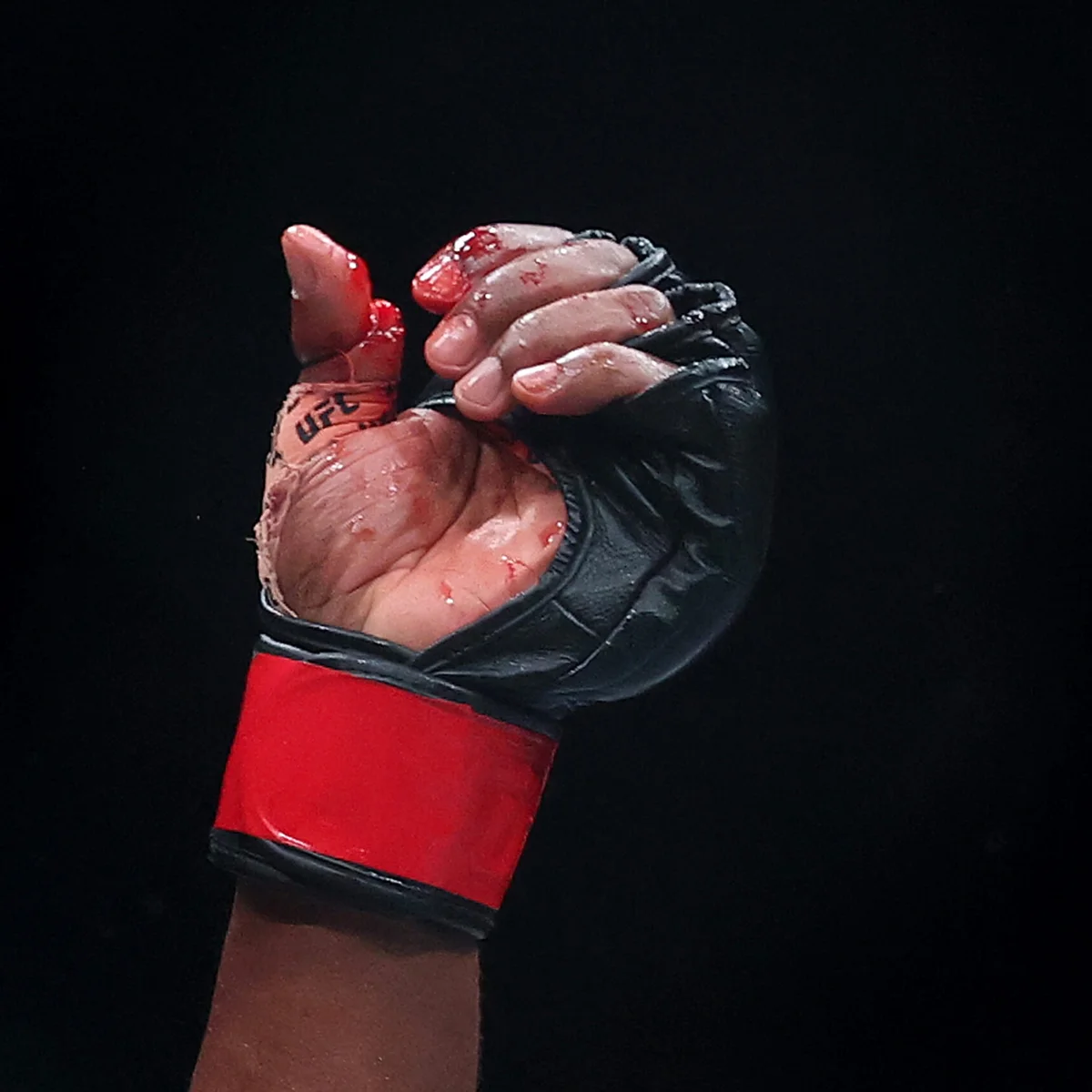 UFC: lutador recebe suspensão de seis meses por fratura exposta em duelo